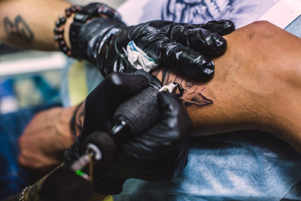 Tattoo removal in RBI Layout at a professional skincare clinic in Bangalore