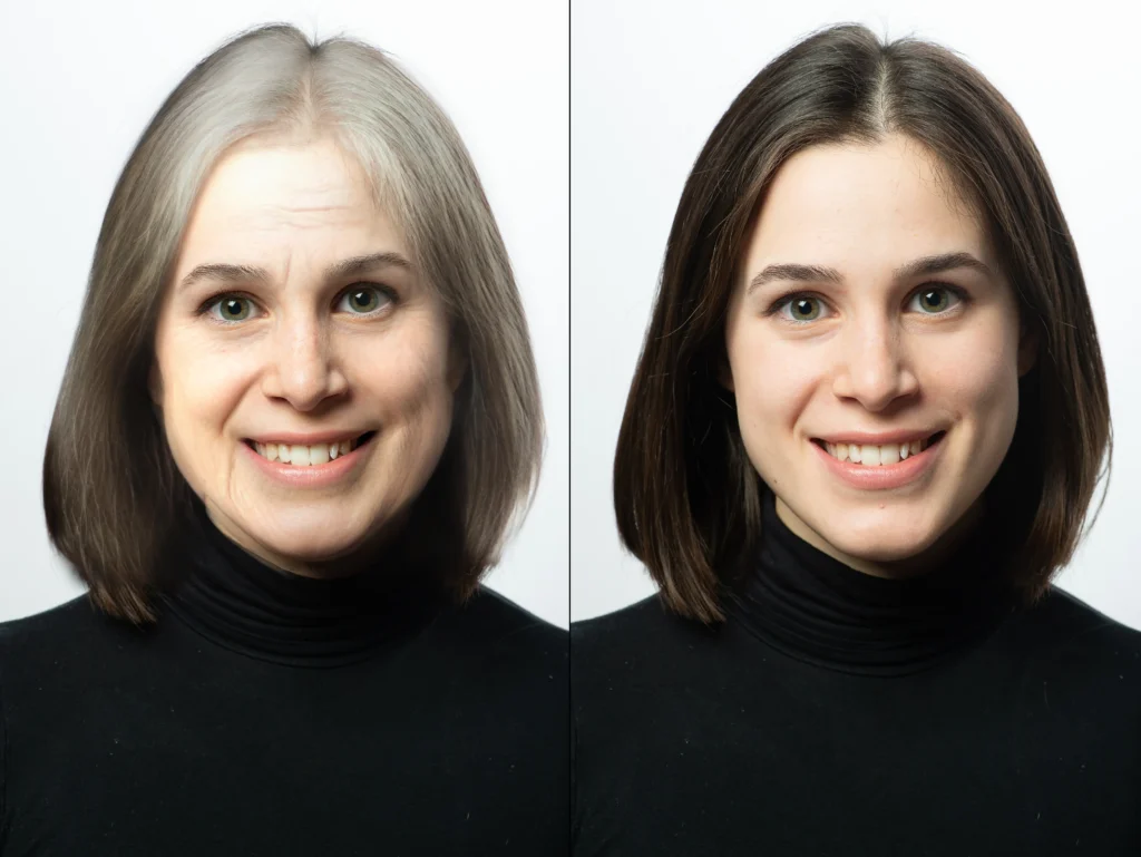 Anti Ageing Treatment